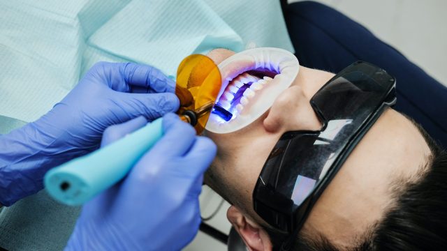 Sbiancamento dentale: in cosa consiste?
